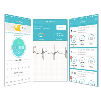 Rýchlo Mini Prenosné prenosné EKG Monitor Meranie Stroj EKG v Reálnom čase srdce Podporu Elektródy Holter Pre systém Android,