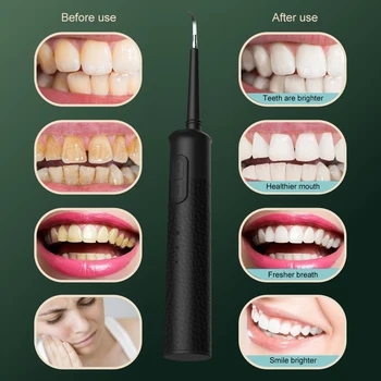 Prenosné USB Nabíjateľné 3 v 1Household Elektrické Zub Cleaner, Elektrické zubné Kefky, Sonic vysokofrekvenčné Čistenie Zubov
