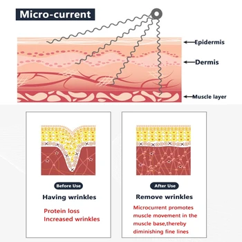 Fototerapia Microcurrent Tváre Masér Nutričné Prieniku Kozmetický Prístroj Pre Face Lifting Spevnenie Omladenie Anti-Aging
