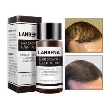LANBENA Rýchlo Silný Rast Vlasov Podstate+Spray, 2 KS Prevencia Plešatosti Konsolidovaného Proti vypadávaniu Vlasov Vyživujú Korene Starostlivosť o Vlasy
