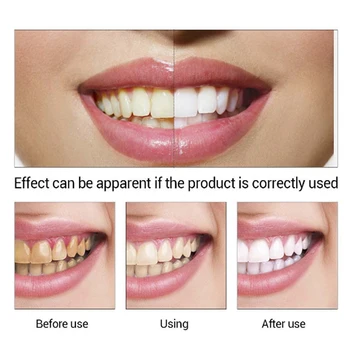 3KS Bieliace Sérum Gélové Zubné Ústnej Hygieny Efektívne Odstránenie Škvŕn Doska Zuby Čistenie Podstate Dentálna hygiena zubná pasta