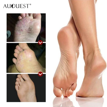 AuQuest Prírodné Nohy Krém Svrbenie Odľahčovacia Anti Blister Foot Masáž Zvlhčovač Pleti Peeling Suchú Pokožku Mozole Na Starostlivosť O Nohy