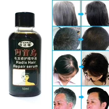 Prírodné organické účinné Čínskej bylinnej medicíny šedivé vlasy liečbu pre biele vlasy terapia žiadne vedľajšie účinky 50ml