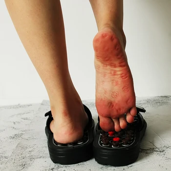 Acupoint Masážne Papuče Pre Mužov A Ženy, Jeden Pár Nôh Sandále, Papuče Reflex Stres Otáčanie Nohy Masáž Unisex Topánky