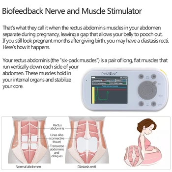 FDA, CE Biofeedback EMG&EMS Terapia Elektrické Panvového dna svaly &FPFD Kegel hra Tréner Popôrodnou Zlepšiť vaginálne moc ŽENY