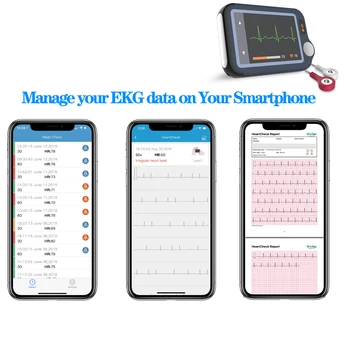 EKG, EKG Monitor Bluetooth Domácnosti Duálny používateľ EKG Monitor Kontinuálne Meranie Arytmie Srdca Pozastaviť spoplatnené EKG PC Zostavy