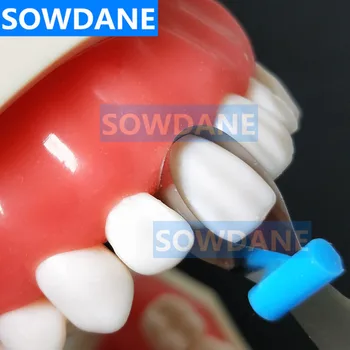 Zubné Twin Predný Matice Zubné Ortodontická Výkres Štylistickými Kovovej Matrice Polyester Matrice Zubár Matice Materiálu